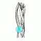 ITB - iliotibial band syndrome