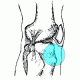 Runners Knee