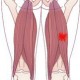 Recurrent Hamstring injuries Recurrent Hamstring injuries