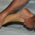 The Procedures of Massage
