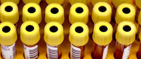 Minimum Doping Ban increased to four years